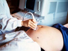 ultrasound scan