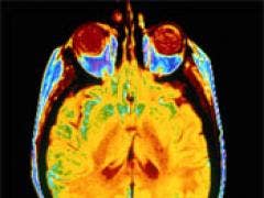 Sex Brain Chip Being Developed brain scan