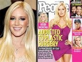 Heidi Montag plastic surgery Spencer Pratt