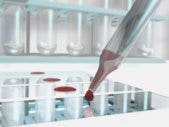 Should Blood Tests Be Required To Get Married? blood