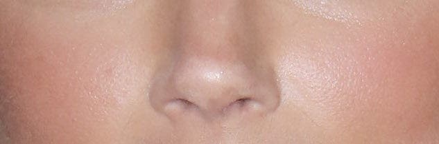 Amber Heard’s nose