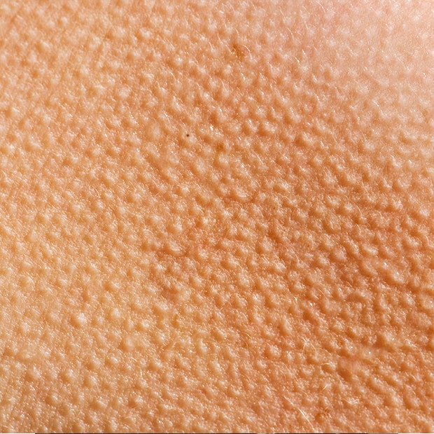 goosebumps up close