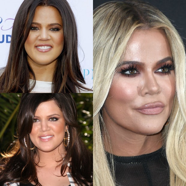 khloe kardashian before and after photos