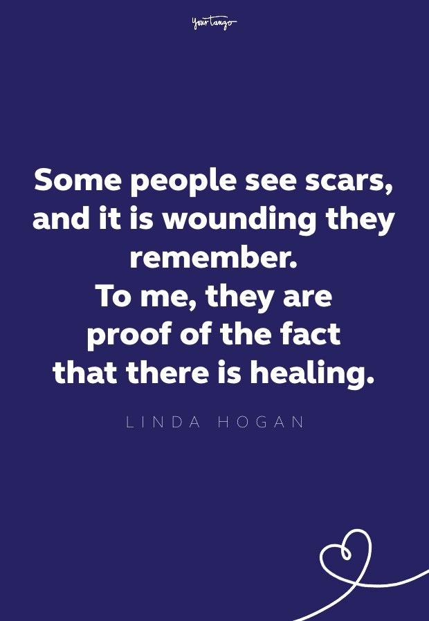 some people see scars, and it is wounding they remember. to me, they are proof of healing