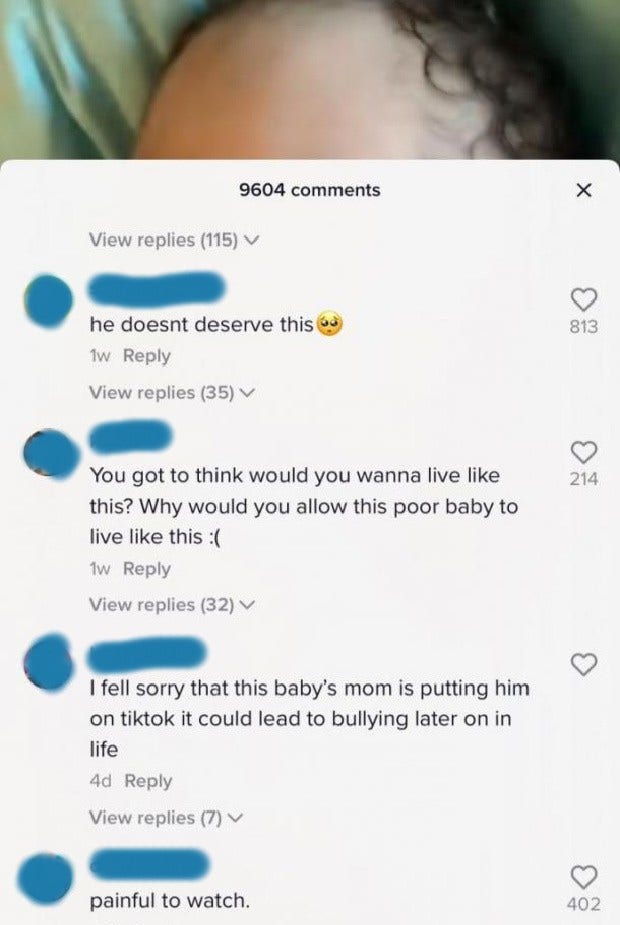 Mean comments on TikTok of baby with HPE