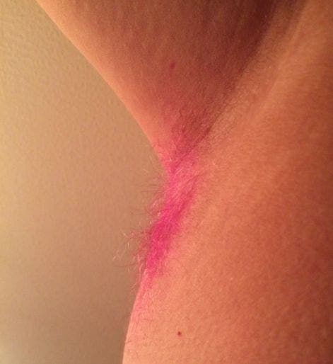 dyed armpit hair