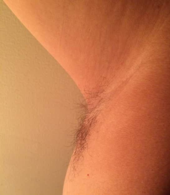 dyed armpit hair
