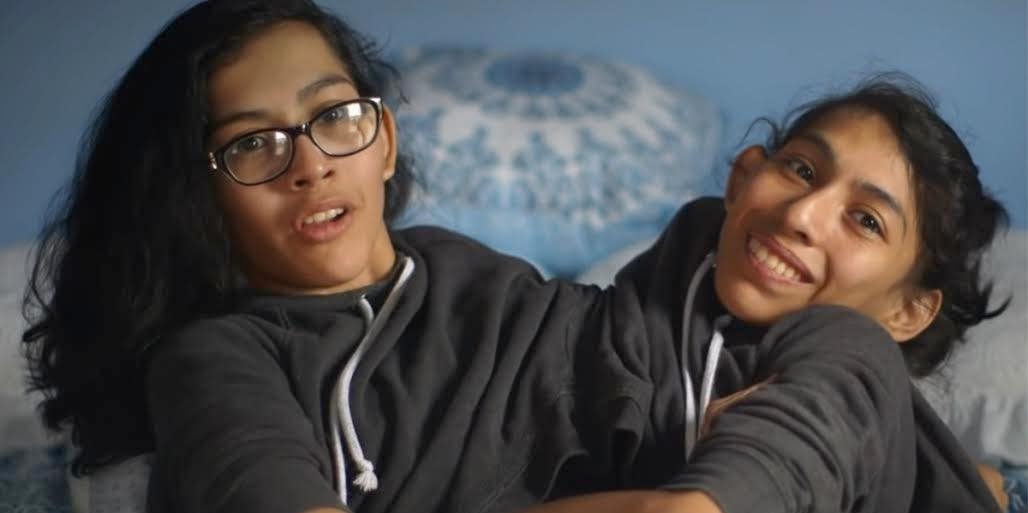 Who Are The Conjoined Twins From TLC's 'Conjoined Twins: Inseparable'? Meet Carmen and Lupita Andrade