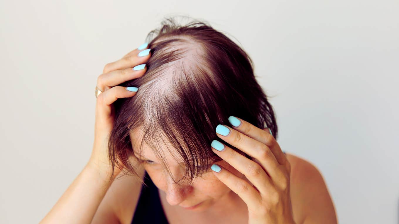 Truths I Wished I’d Known Earlier About Going Bald Wishing she knew earlier about going bald