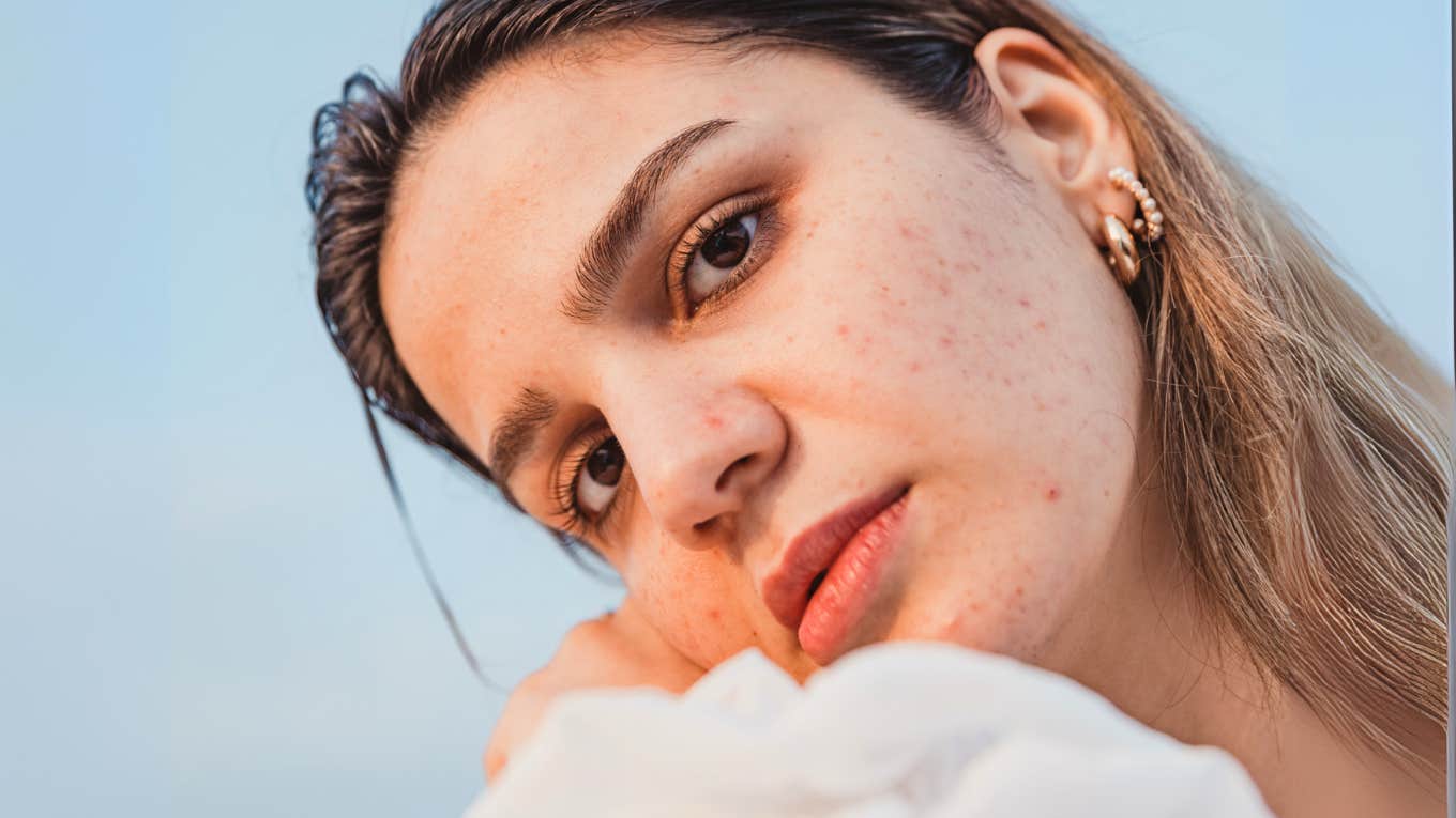 Hormones Might Be Behind These Surprising Changes in Your Appearance, Says Research Woman experiencing surprising changes in appearance, due to hormones.