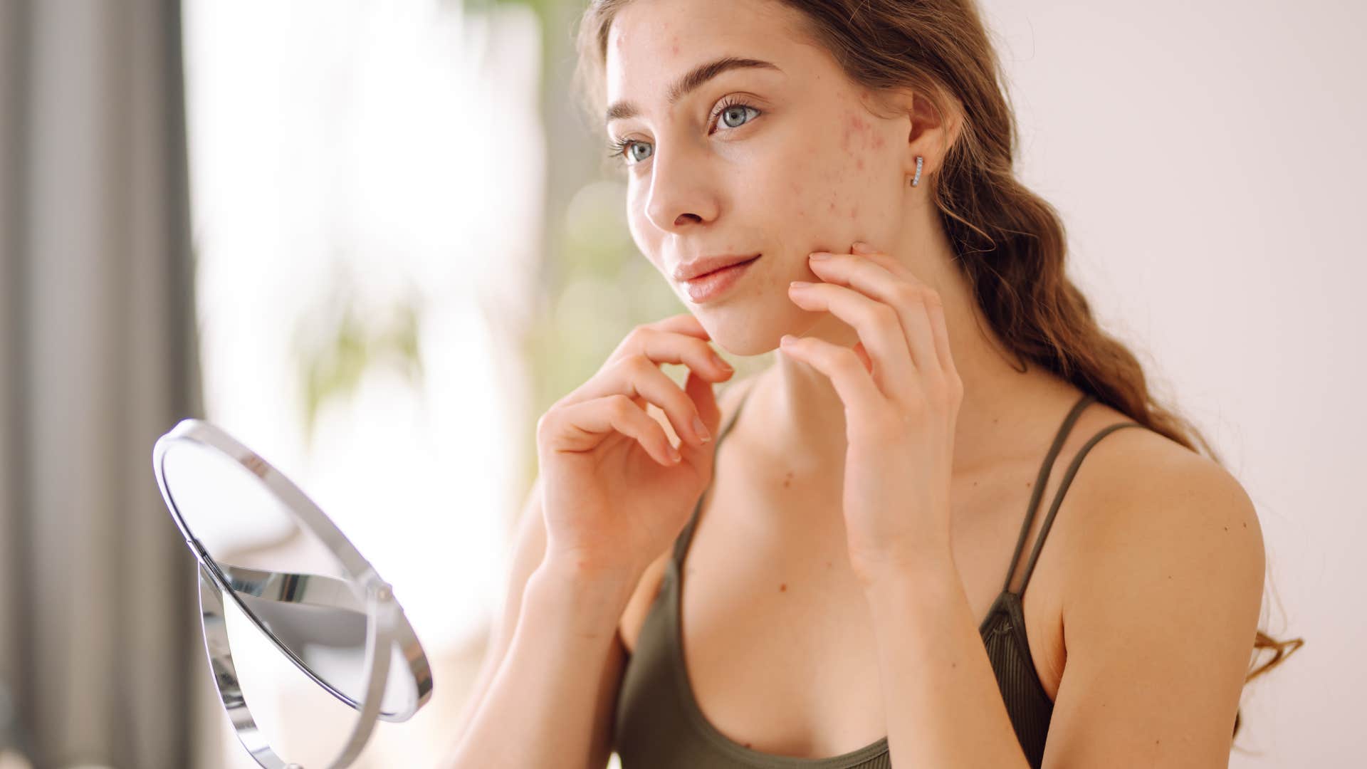 woman with acne as surprising change in appearance