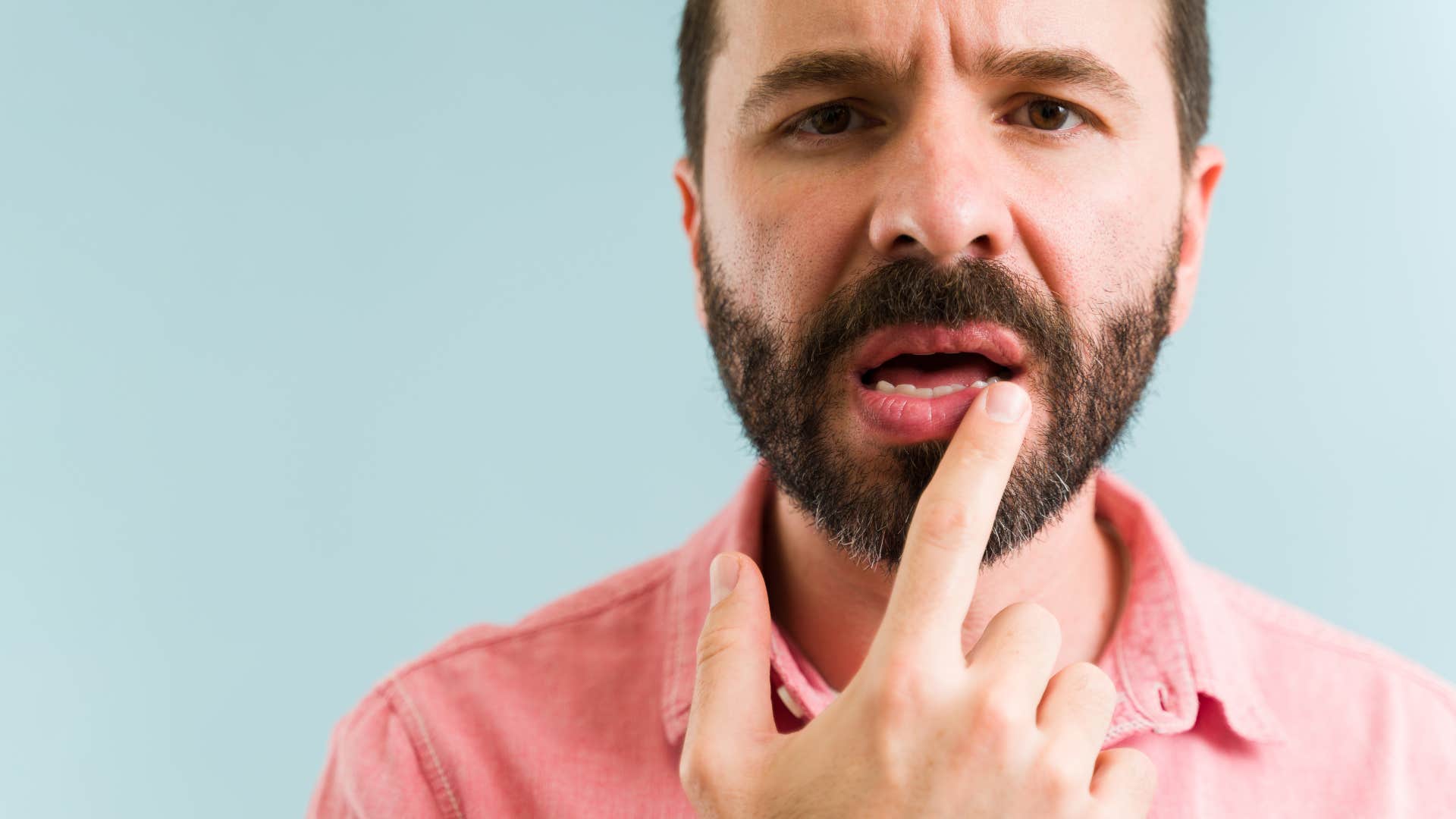 Man with chapped lips looking at the camera.