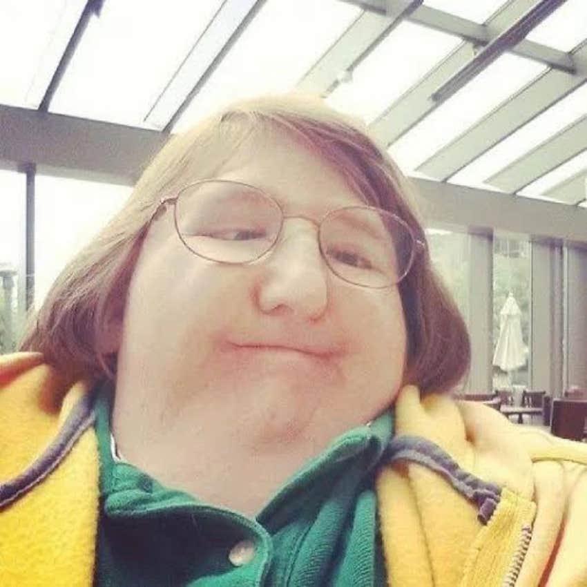 woman whose disability would make her a better partner by forcing her to be herself