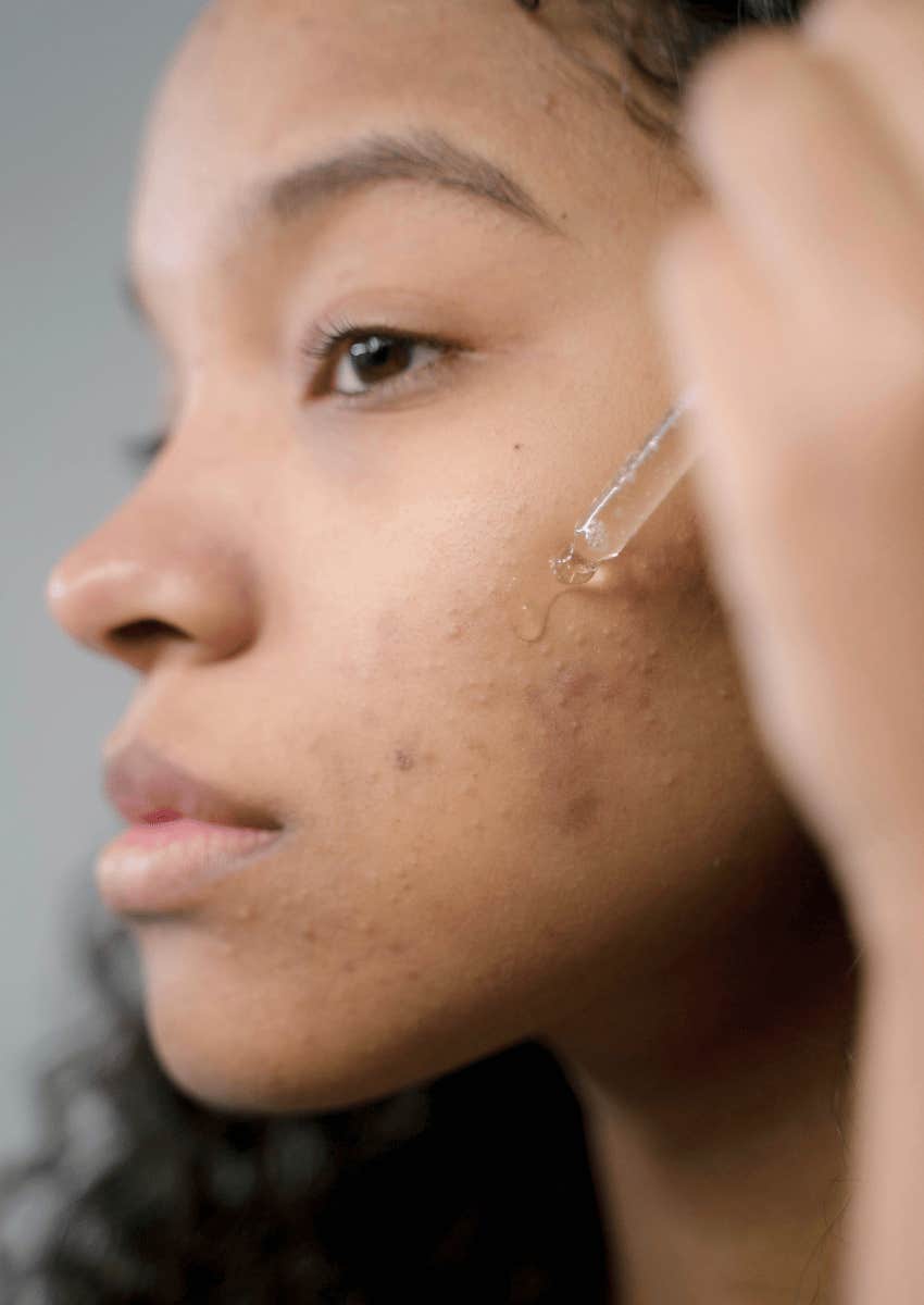 young woman applying serum to her face