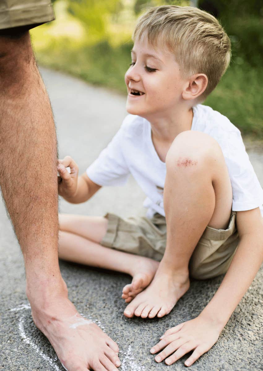 child with a scraped knee playing outside