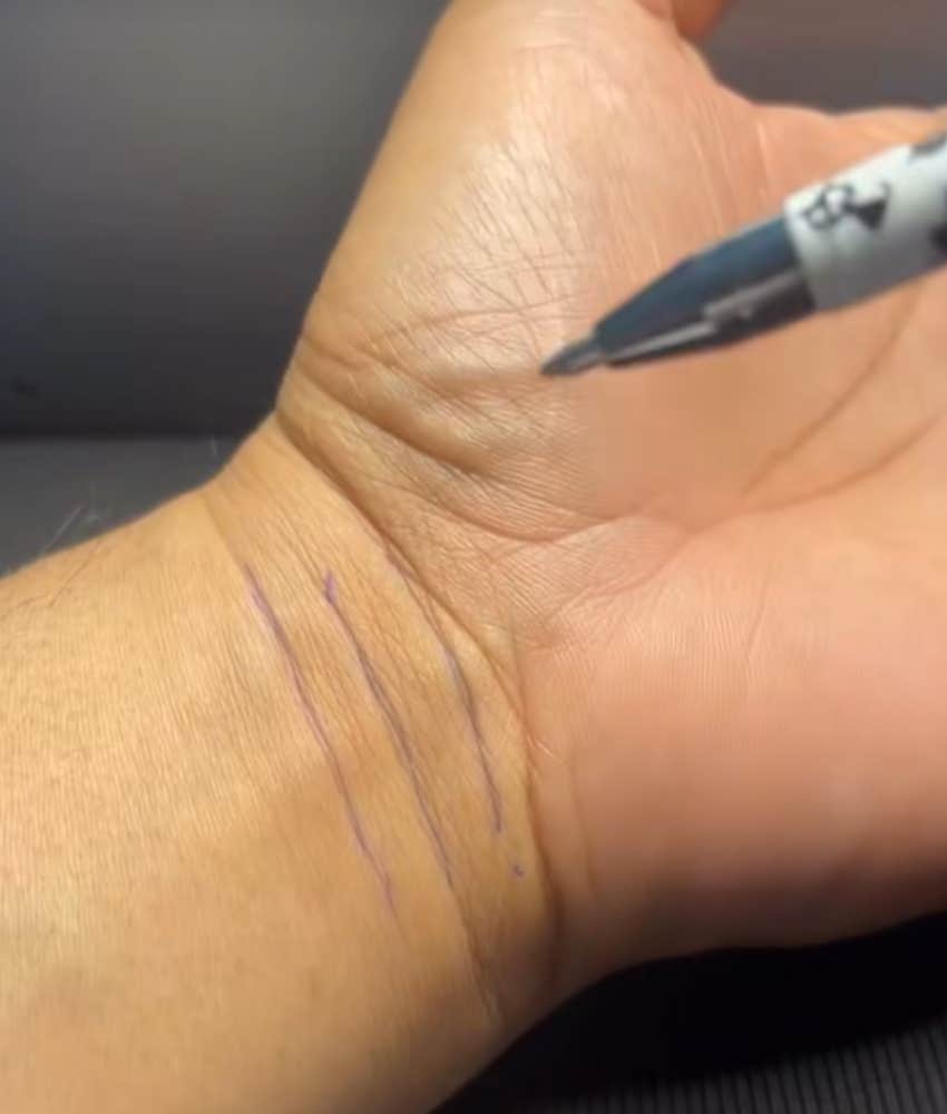 bracelet lines