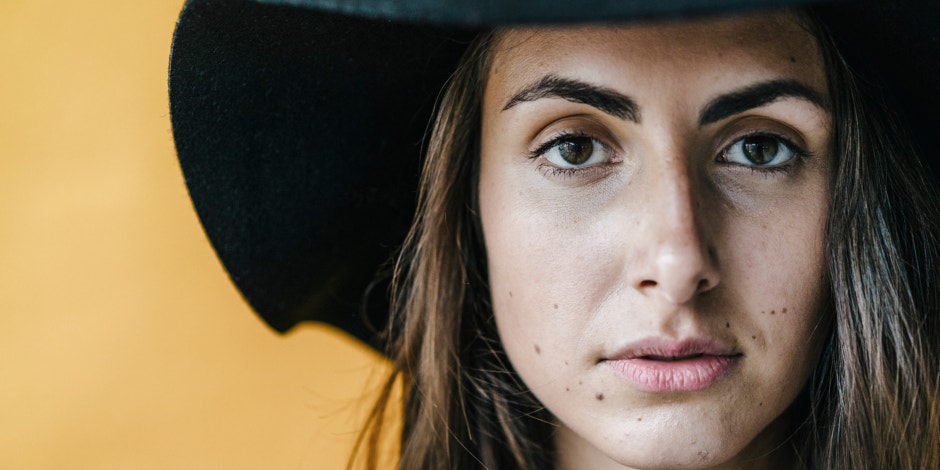 What Your Birthmark Says About You, Based On Superstition What Your Birthmark Says About You, Based On Superstition