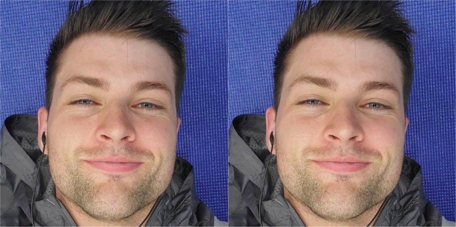Who Is Kevin Fortenberry? New Details On 'The Bachelorette' Contestant's Injury And Whether It Was Luke P's Fault