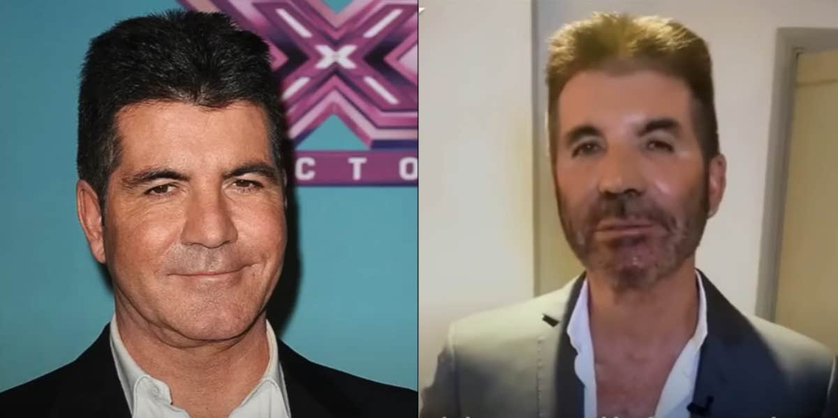 Trolls Accuse Simon Cowell Of Looking Like A Wax Figure From Madame Tussaud's Museum Simon Cowell before and after