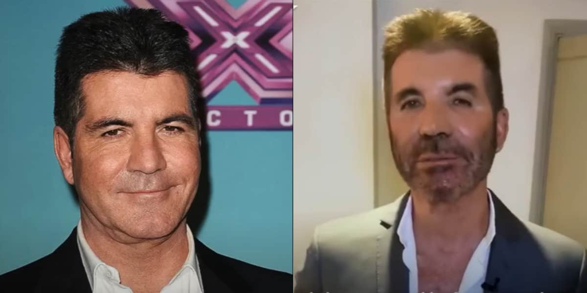 Simon Cowell before and after