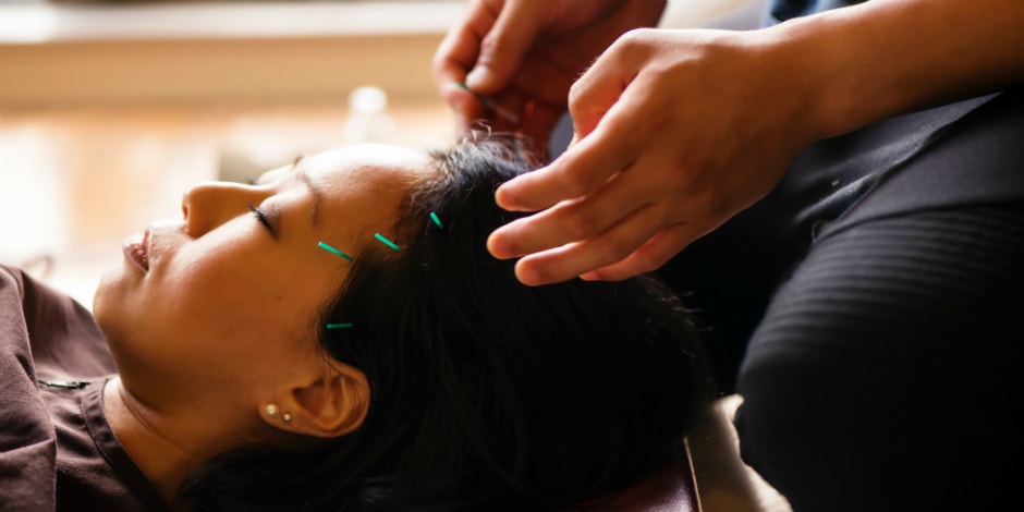 Does Acupuncture Help With Weight Loss? Does Acupuncture Help With Weight Loss?