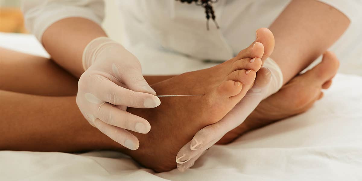 acupuncture on foot
