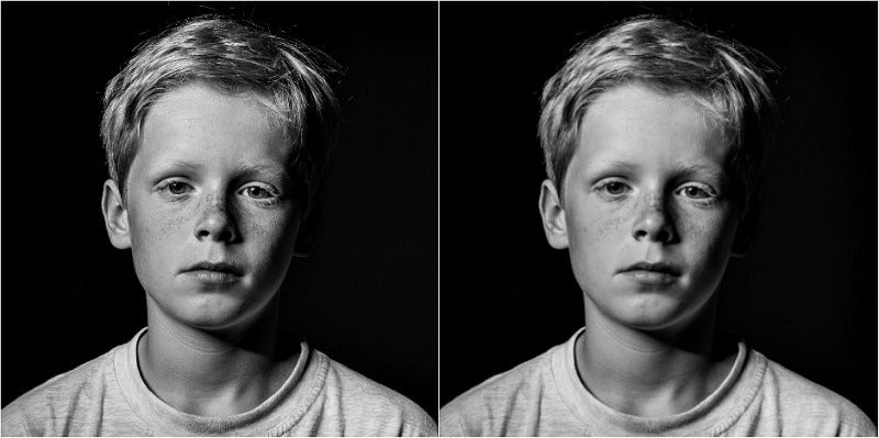 What Is Adopted Child Syndrome And Why Should Parents Care? What Is Adopted Child Syndrome And Why Should Parents Care?