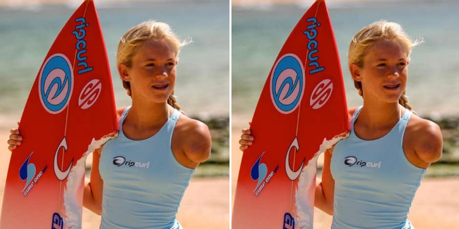 Who Is Bethany Hamilton? New Details On The Surfer Who Lost Her Arm To Shark Attack At 13 And The New Documentary About Her Who Is Bethany Hamilton? New Details On The Surfer Who Lost Her Arm To Shark Attack At 13 And The New Documentary About Her