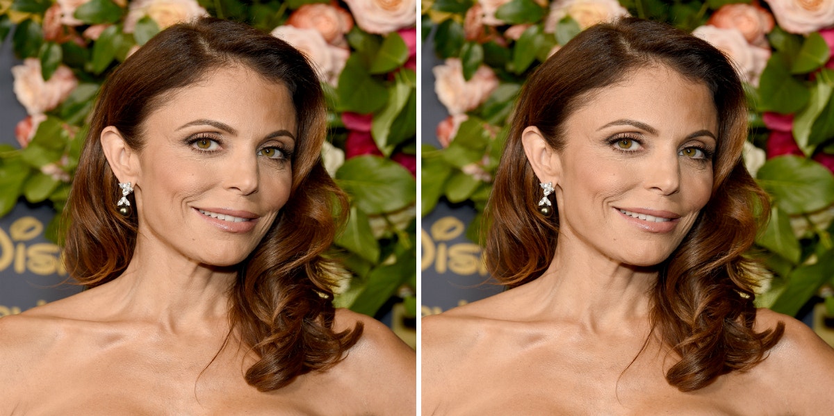 Did Bethenny Frankel Get Plastic Surgery? Before/After Photos And What She's Rumored To Have Gotten Done 