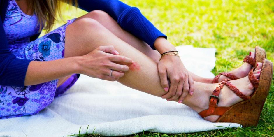 essential oils for bug bites essential oils for bug bites