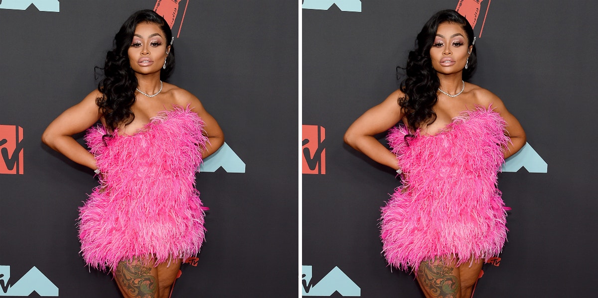 Did Blac Chyna Get Her Butt Implants Removed? Before/After Photos Reveal Major Change In Her Derriere Did Blac Chyna Get Her Butt Implants Removed? Before/After Photos Reveal Major Change In Her Derriere