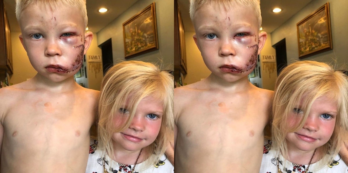 6-Year-Old Boy Hailed As Hero After Saving Sister From Dog Attack