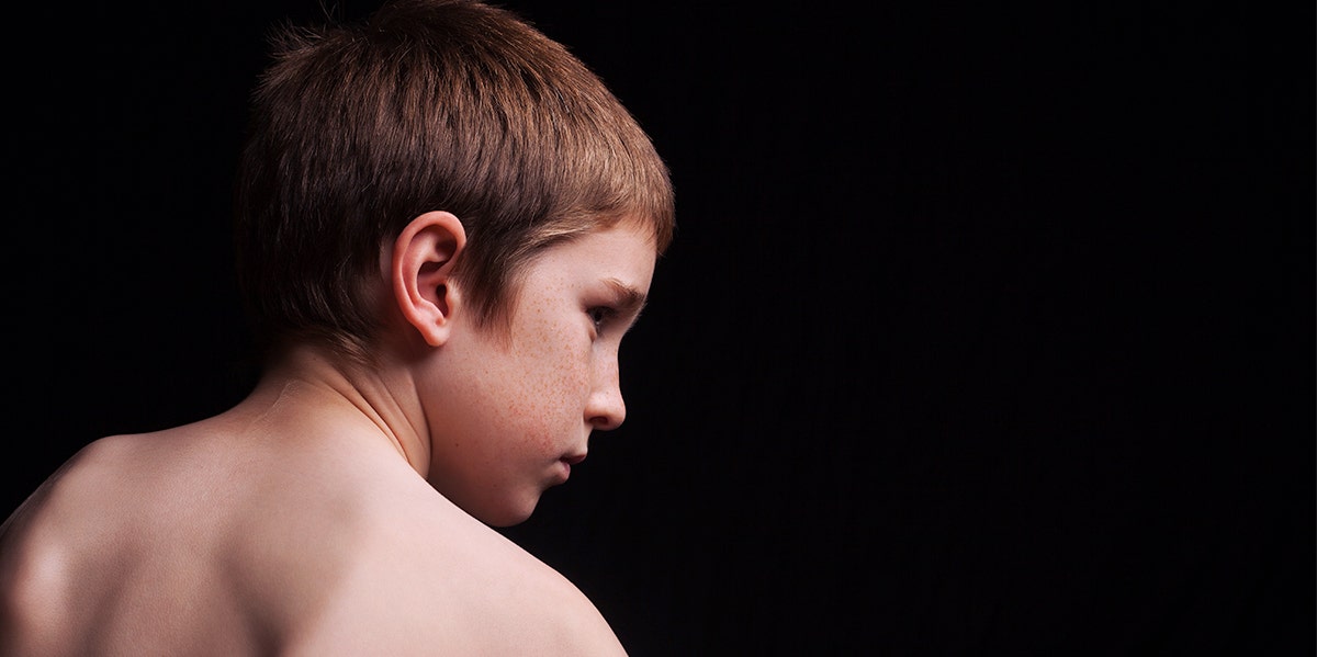 This Bullied 6-Year-Old Got Plastic Surgery To Fix His Prominent "Elf Ears" sad boy