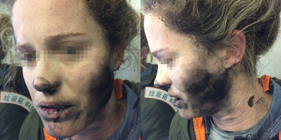 The Scary Reason This Woman's Headphones Exploded During Her Flight The Scary Reason This Woman's Headphones Exploded During Her Flight