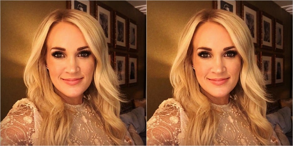 Carrie Underwood Shows Face Scars From Fall in New Close-Up Photo