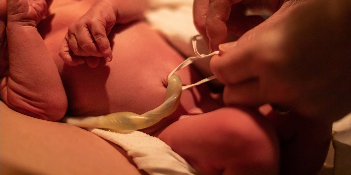 Moms Are Making Umbilical Cord Art Now Because Of Course They Are