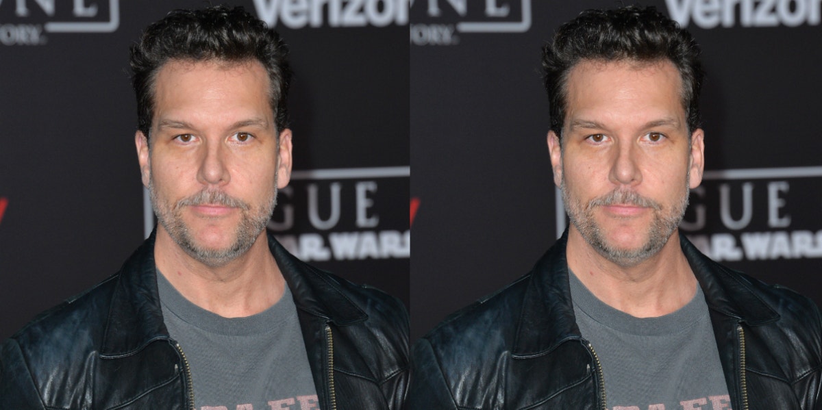 Did Dane Cook Get Plastic Surgery?