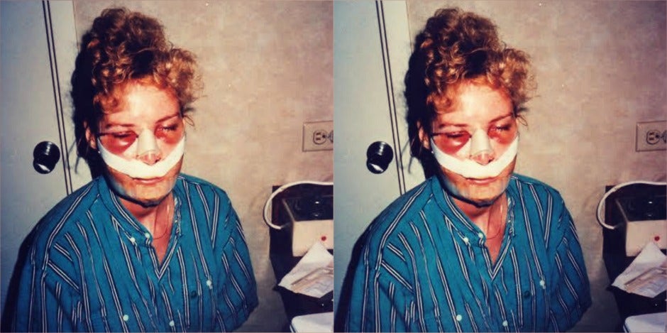 facial deformity facial deformity