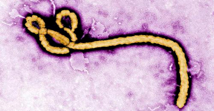 ebola virus