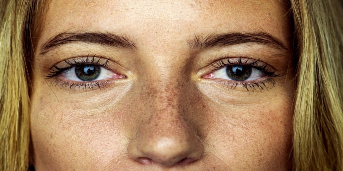 woman freckled face