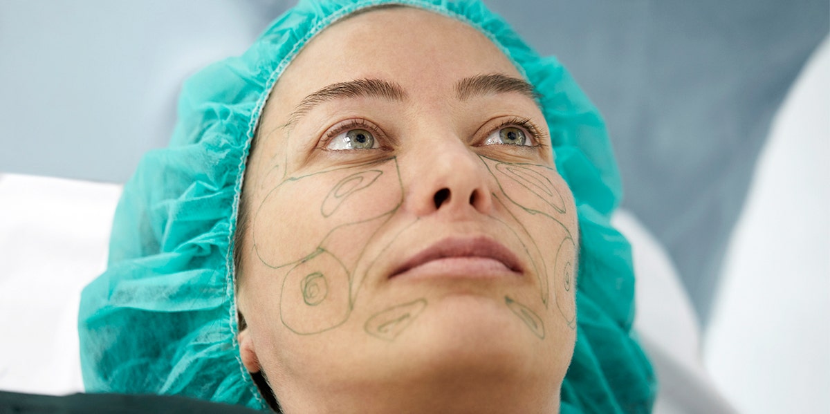 Before/After Photos Of A Facelift That Removes 10 Years Of Aging In 30 Minutes woman in medical gown