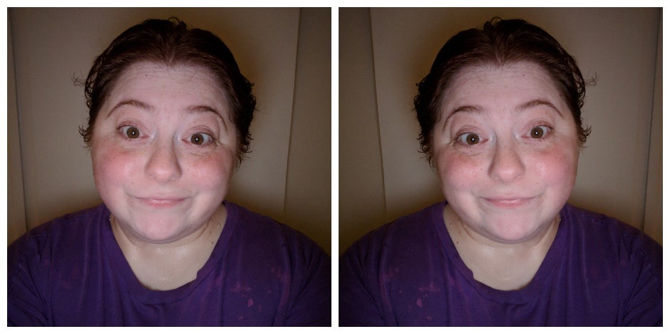 fat obese woman fat obese woman