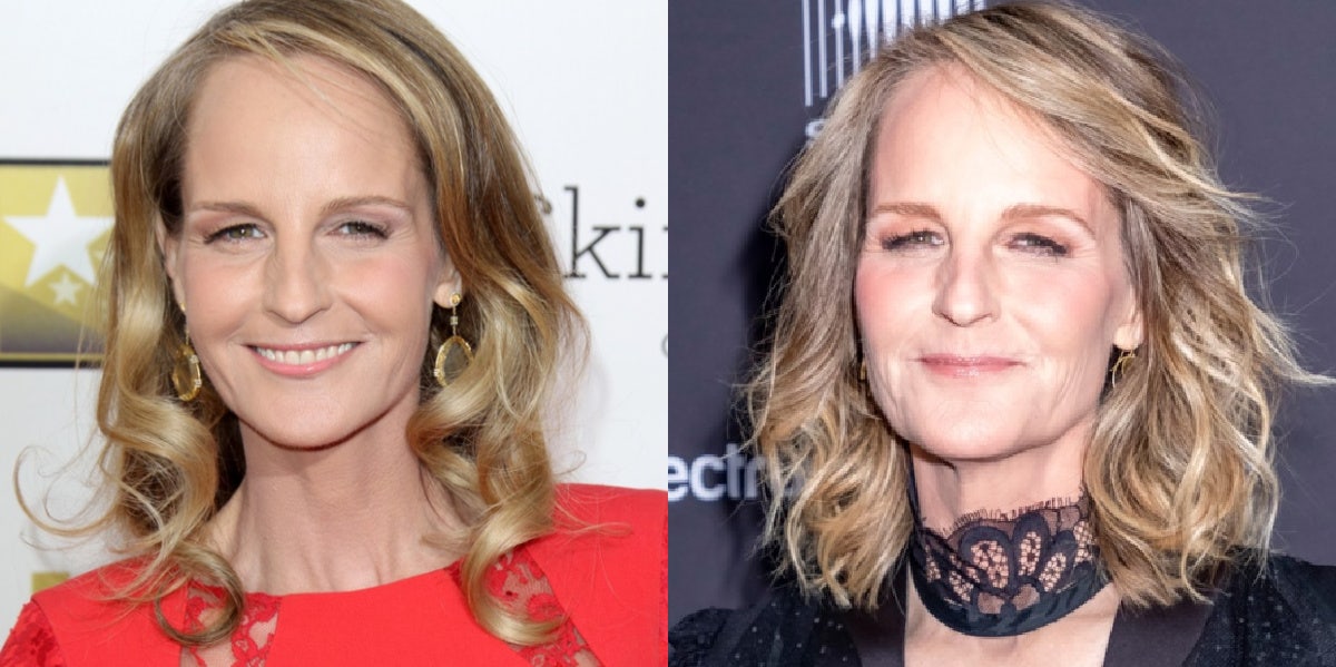 Helen Hunt plastic surgery photos