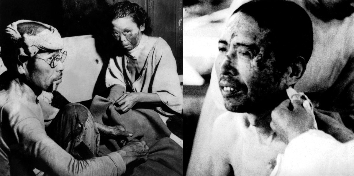 Hiroshima Atomic Bomb Survivors