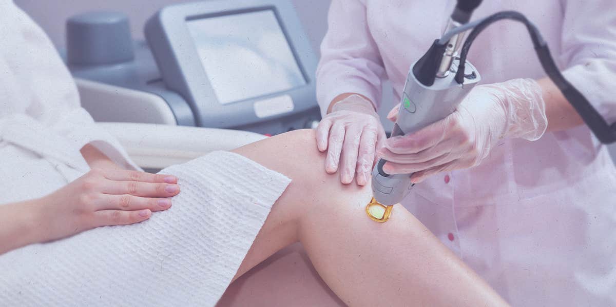 How To Prevent Ingrown Hairs & Best Treatment Options laser hair removal