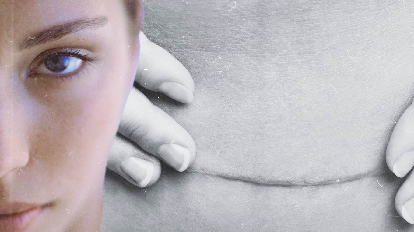 I Was Bullied Into Having A C-Section C-Section