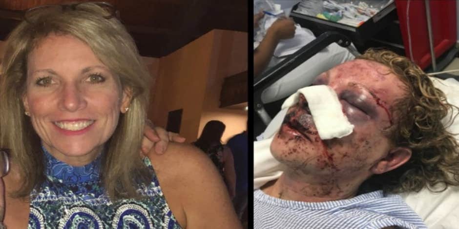 Is Tammy Lawrence Lying About Being Beaten At Dominican Republic Resort? New Details On The Hotel's Claims That She Was Nowhere Near As Beaten As She Appeared