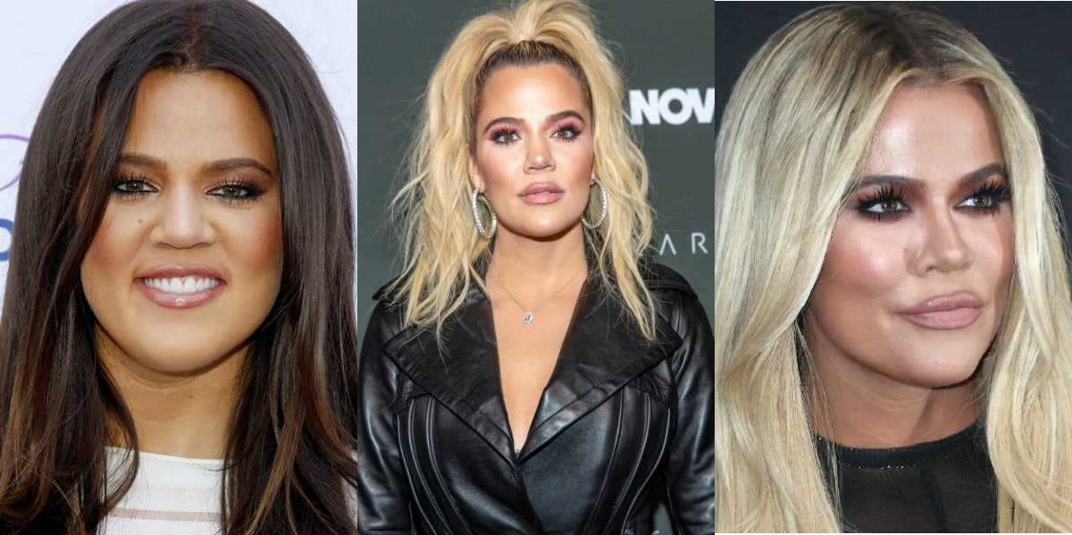 Khloé Kardashian Plastic Surgery: Before/After Nose Job Photos Khloe Kardashian before and after alleged plastic surgery