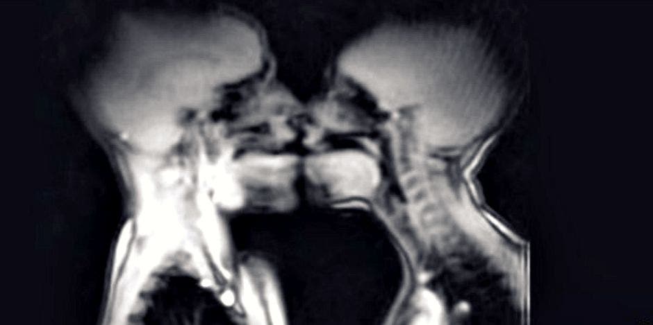 mri mri