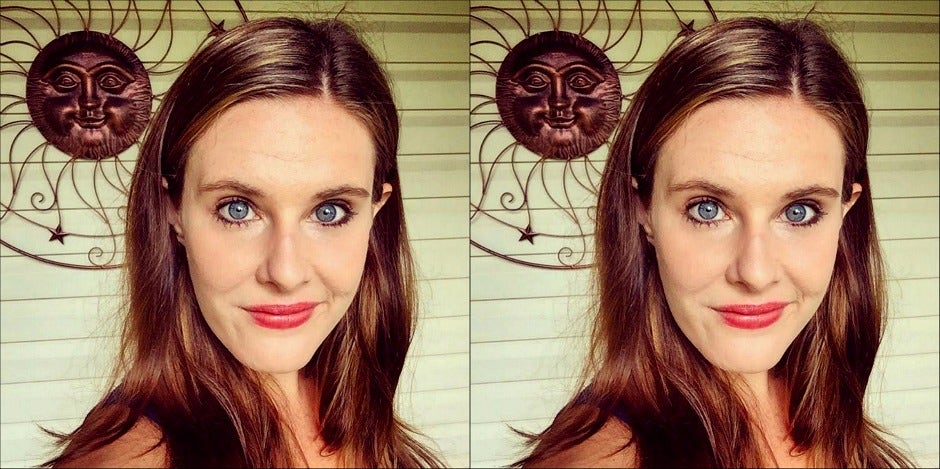 Forehead wrinkle Forehead wrinkle
